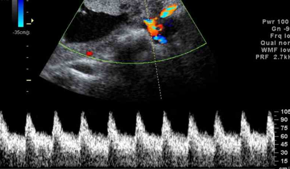 Ecocardiografías Guanajuato